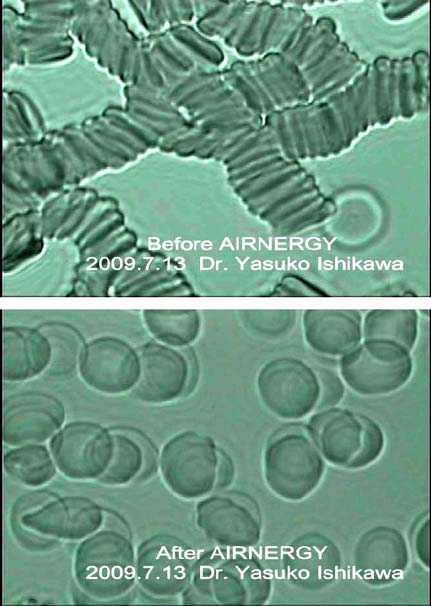 Bild: Zellen-Mikroskop-Aufnahme, Verändernde Wirkung von Airnergy auf die Blutzellen